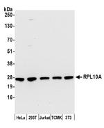 RPL10A/Ribosomal Protein L10a Antibody in Western Blot (WB)