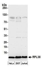 RPL38/Ribosomal Protein L38 Antibody in Western Blot (WB)