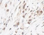 RPL5 Antibody in Immunohistochemistry (IHC)