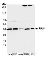 RPL5 Antibody in Western Blot (WB)