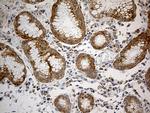 RPL7A Antibody in Immunohistochemistry (Paraffin) (IHC (P))