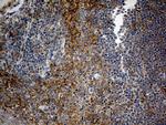 RPL7A Antibody in Immunohistochemistry (Paraffin) (IHC (P))