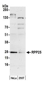 RPP25 Antibody in Western Blot (WB)