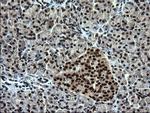 RPRD1B Antibody in Immunohistochemistry (Paraffin) (IHC (P))