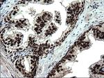 RPRD1B Antibody in Immunohistochemistry (Paraffin) (IHC (P))