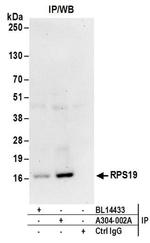 RPS19 Antibody in Western Blot (WB)