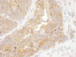 RPS5 Antibody in Immunohistochemistry (Paraffin) (IHC (P))