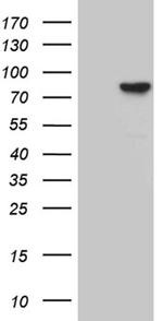 RPS6KA2 Antibody in Western Blot (WB)