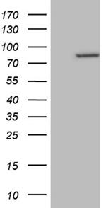 RPS6KA2 Antibody in Western Blot (WB)