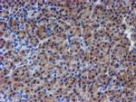 RPS6KB1 Antibody in Immunohistochemistry (Paraffin) (IHC (P))