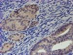 RPS6KB1 Antibody in Immunohistochemistry (Paraffin) (IHC (P))