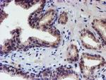 RPS6KB1 Antibody in Immunohistochemistry (Paraffin) (IHC (P))