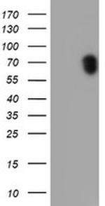 RPS6KB1 Antibody in Western Blot (WB)