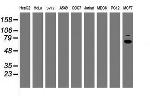 RPS6KB1 Antibody in Western Blot (WB)