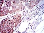 p70 S6 Kinase Antibody in Immunohistochemistry (Paraffin) (IHC (P))