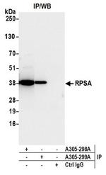 RPSA Antibody in Western Blot (WB)