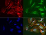 RRM1 Antibody in Immunocytochemistry (ICC/IF)