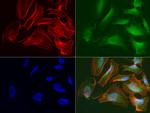 RRM1 Antibody in Immunocytochemistry (ICC/IF)