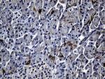 RRM1 Antibody in Immunohistochemistry (Paraffin) (IHC (P))