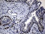 RRM1 Antibody in Immunohistochemistry (Paraffin) (IHC (P))