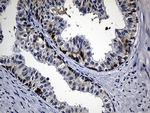 RRM1 Antibody in Immunohistochemistry (Paraffin) (IHC (P))