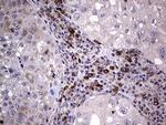 RRM1 Antibody in Immunohistochemistry (Paraffin) (IHC (P))