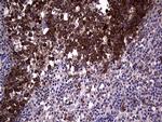 RRM1 Antibody in Immunohistochemistry (Paraffin) (IHC (P))