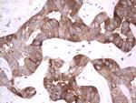 RRM1 Antibody in Immunohistochemistry (Paraffin) (IHC (P))