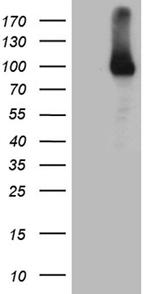 RRM1 Antibody in Western Blot (WB)