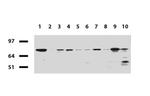 RRM1 Antibody in Western Blot (WB)