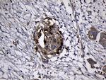 RRM2 Antibody in Immunohistochemistry (Paraffin) (IHC (P))