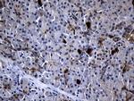 RRM2 Antibody in Immunohistochemistry (Paraffin) (IHC (P))