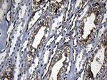 RRM2 Antibody in Immunohistochemistry (Paraffin) (IHC (P))