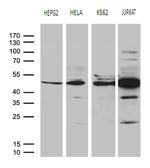 RRM2 Antibody in Western Blot (WB)