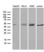 RRM2 Antibody in Western Blot (WB)