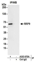 RRP9 Antibody in Western Blot (WB)