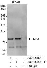 RSK1 Antibody in Immunoprecipitation (IP)