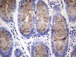 RSPO1 Antibody in Immunohistochemistry (Paraffin) (IHC (P))