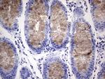 RSPO1 Antibody in Immunohistochemistry (Paraffin) (IHC (P))