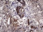 RSPO3 Antibody in Immunohistochemistry (Paraffin) (IHC (P))