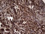 RSPO3 Antibody in Immunohistochemistry (Paraffin) (IHC (P))