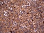 RSPO3 Antibody in Immunohistochemistry (Paraffin) (IHC (P))