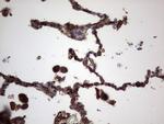 RSPO3 Antibody in Immunohistochemistry (Paraffin) (IHC (P))