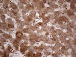 RSPO3 Antibody in Immunohistochemistry (Paraffin) (IHC (P))