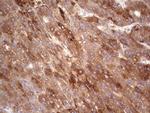 RSPO3 Antibody in Immunohistochemistry (Paraffin) (IHC (P))