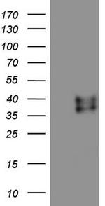 RSPO3 Antibody in Western Blot (WB)