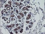 RTKN Antibody in Immunohistochemistry (Paraffin) (IHC (P))