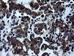 RTKN Antibody in Immunohistochemistry (Paraffin) (IHC (P))