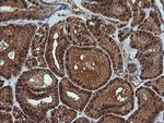 RTKN Antibody in Immunohistochemistry (Paraffin) (IHC (P))