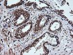 RTKN Antibody in Immunohistochemistry (Paraffin) (IHC (P))